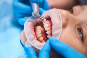 Periapical X-Rays: The Complete Patient Guide to Dental Root Imaging